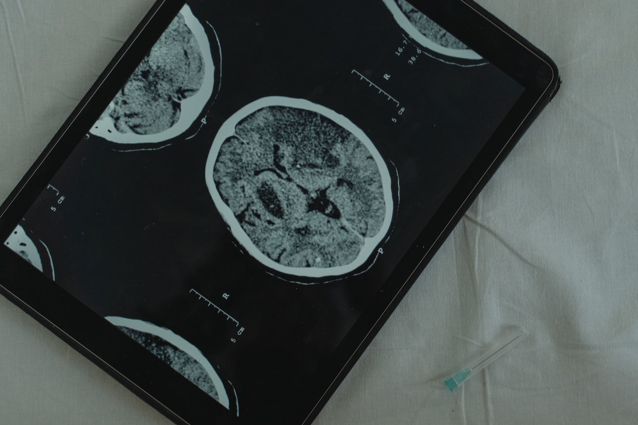 brain images on tablet